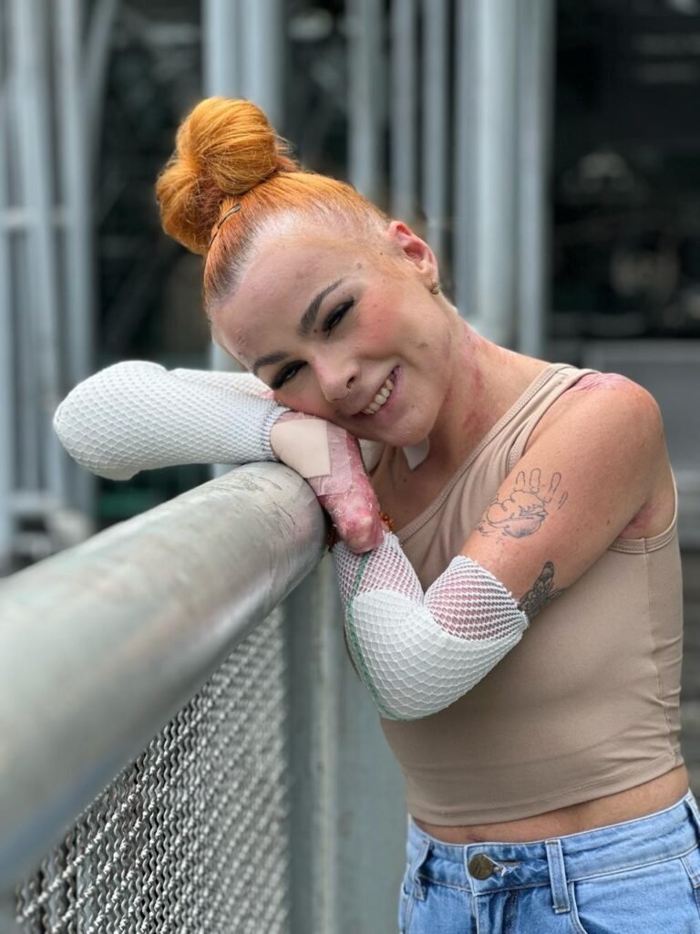 Desafios da Epidermólise Bolhosa: Uma Realidade Dolorosa