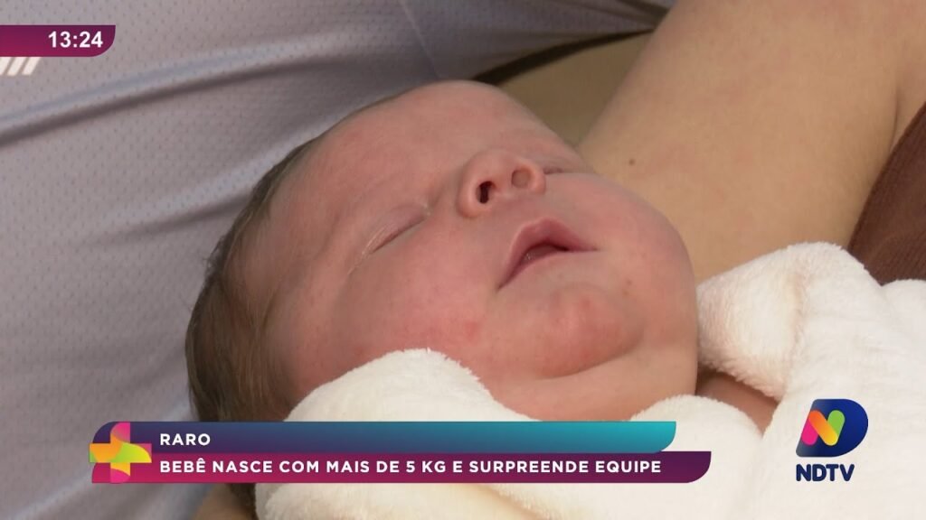 Nascimentos Raros: O Impacto de Bebês Gigantes na Saúde